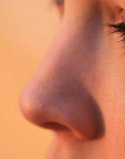 New Nose 1