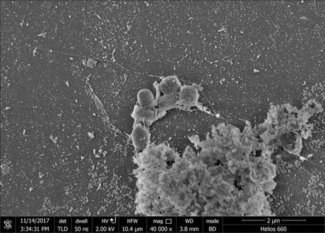 Plastic Eating Bacteria 1